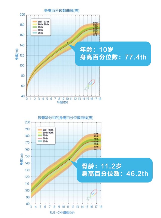 如何正確理解，科學評價孩子的身高？_06.jpg