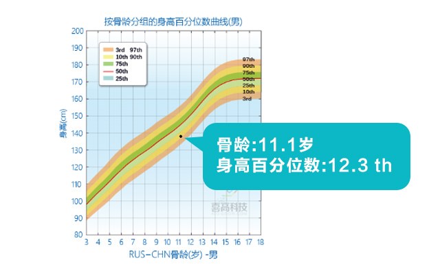 判斷孩子的高矮？這3點(diǎn)沒搞清楚會后悔！_05.jpg