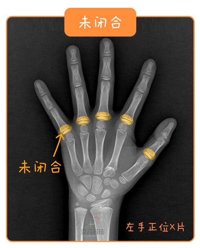 重啟骨骺線~你看起來很誘人！_12.jpg