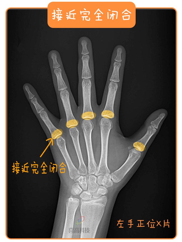 重啟骨骺線~你看起來很誘人！_13.png